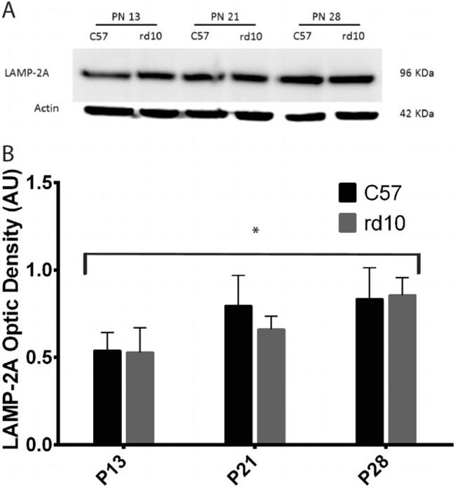 LAMP-2A Antibody in Western Blot (WB)