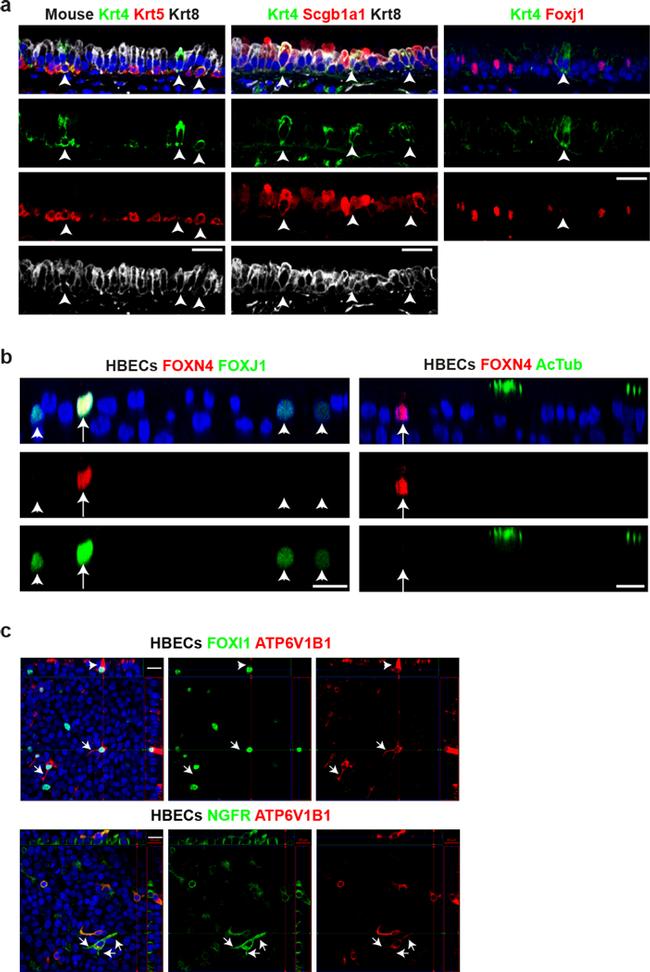 NGFR Antibody in Immunocytochemistry (ICC/IF)