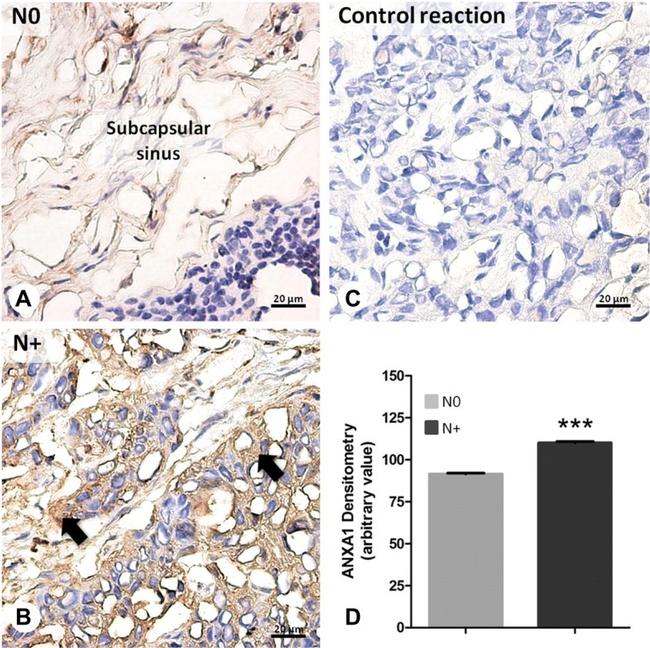 Annexin A1 Antibody in Immunohistochemistry (IHC)