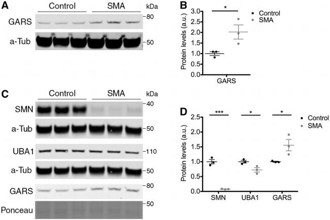 UBE1 Isoform A/B Antibody in Western Blot (WB)