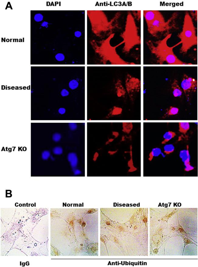 LC3A/LC3B Antibody in Immunocytochemistry (ICC/IF)