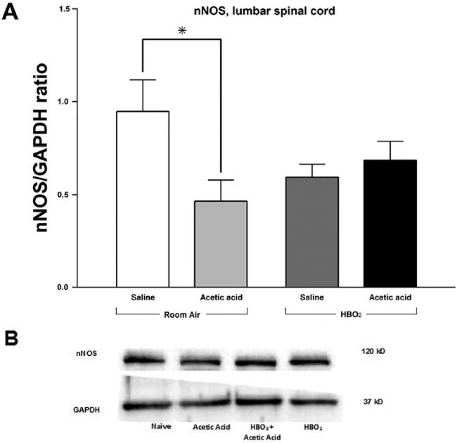 GAPDH Antibody in Western Blot (WB)