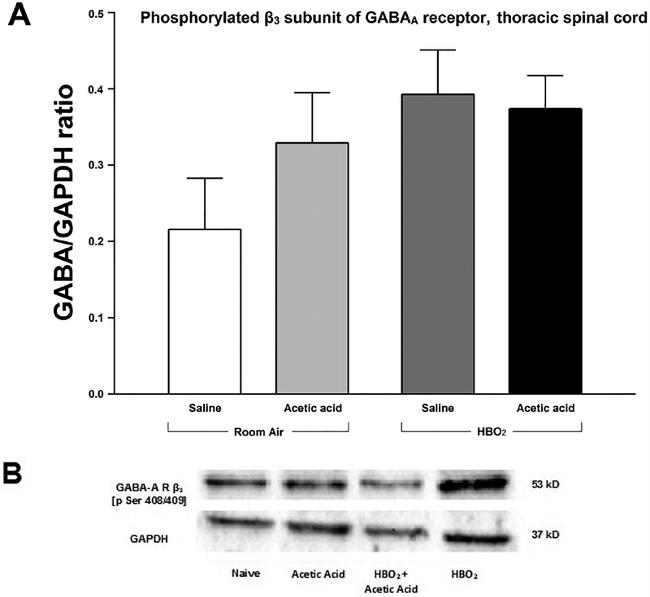 GAPDH Antibody in Western Blot (WB)