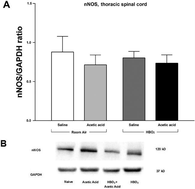 GAPDH Antibody in Western Blot (WB)