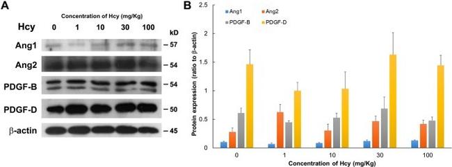 PDGF-D Antibody in Western Blot (WB)