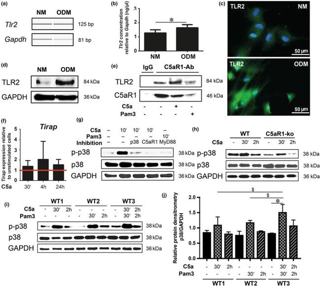 C5AR1 Antibody in Western Blot (WB)