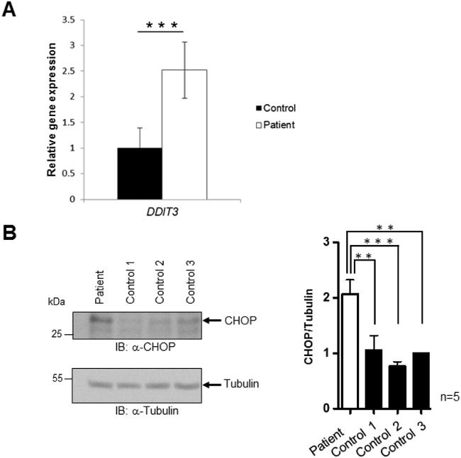 CHOP Antibody in Western Blot (WB)