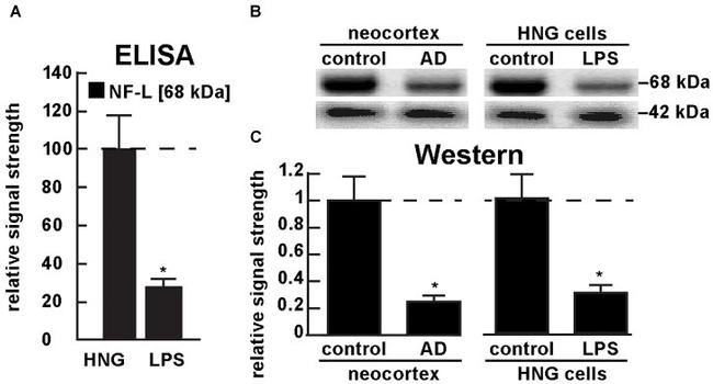 NEFL Antibody in Western Blot (WB)