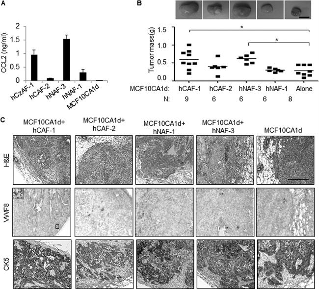 Cytokeratin 5 Antibody in Immunohistochemistry (Paraffin) (IHC (P))