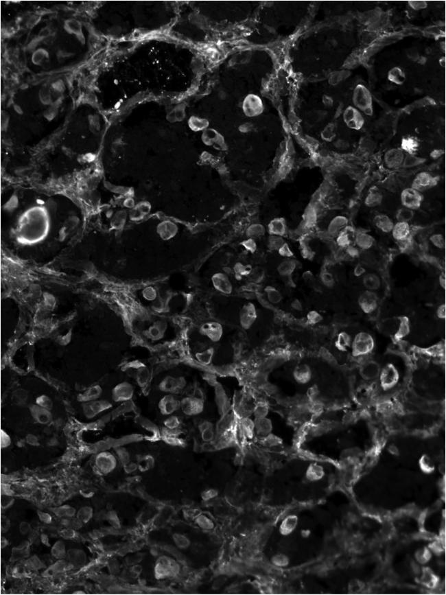 ACTH Antibody in Immunocytochemistry (ICC/IF)