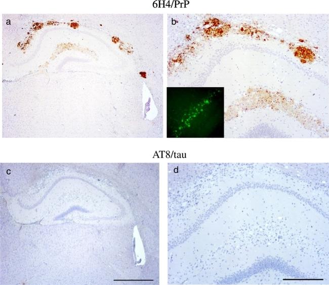 Tau Antibody in Immunohistochemistry (Paraffin) (IHC (P))