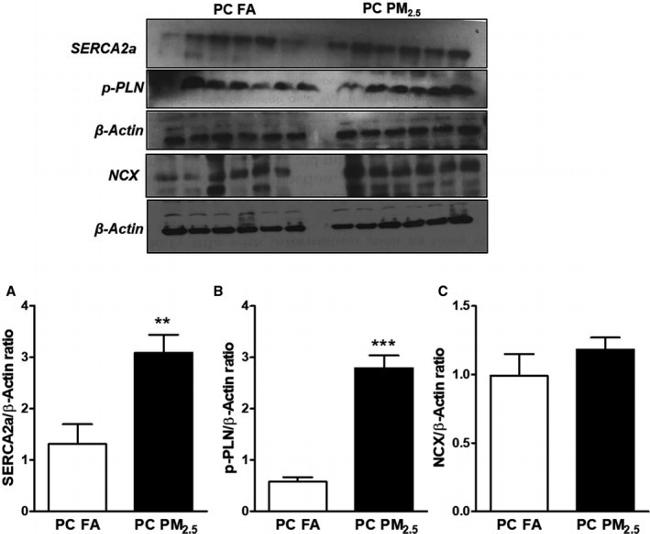 SERCA2 ATPase Antibody in Western Blot (WB)