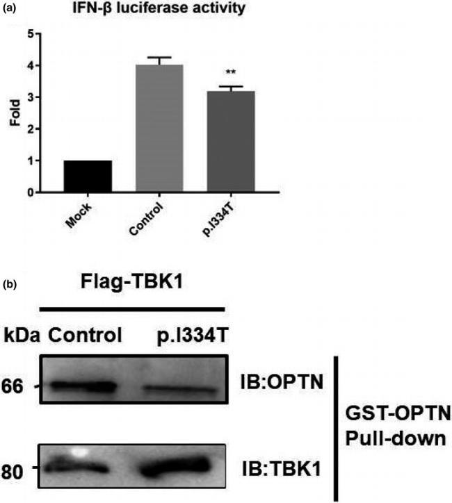 TBK1 Antibody in Western Blot (WB)