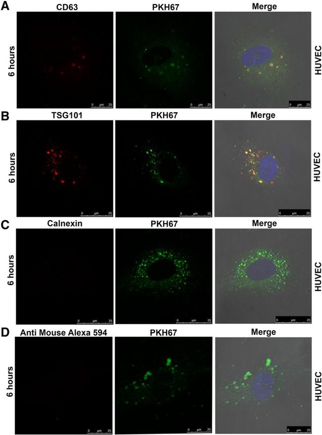 TSG101 Antibody in Immunocytochemistry (ICC/IF)