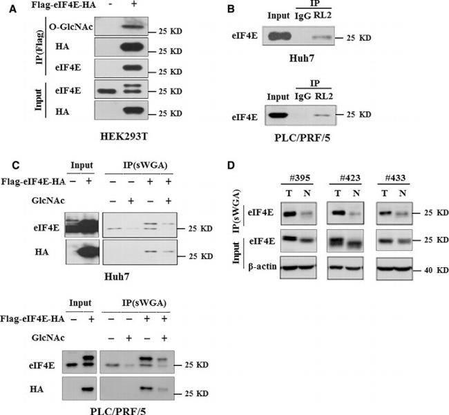 O-linked N-acetylglucosamine (O-GlcNAc) Antibody in Western Blot, Immunoprecipitation (WB, IP)