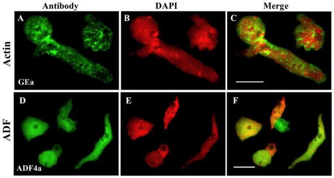 Actin Antibody in Immunocytochemistry (ICC/IF)