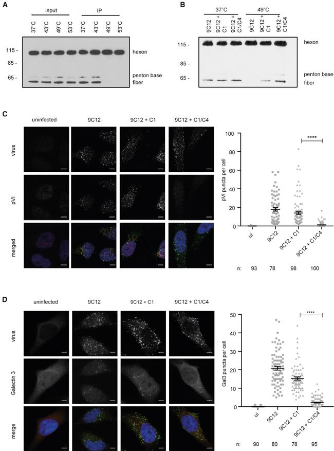 Galectin 3 Antibody in Immunocytochemistry (ICC/IF)