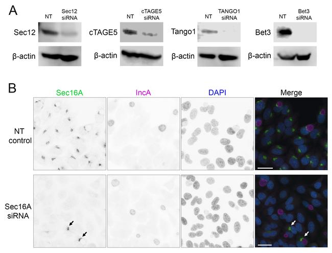 PREB Antibody in Western Blot (WB)