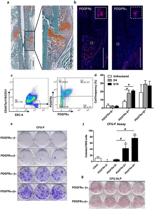 PDGFRB Antibody in Immunohistochemistry (IHC)