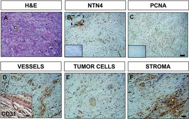 PCNA Antibody in Immunohistochemistry (IHC)