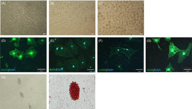 PAX6 Antibody in Immunocytochemistry (ICC/IF)