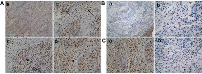 p16INK4a Antibody in Immunohistochemistry (IHC)