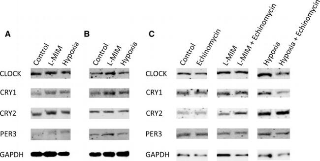 CRY1 Antibody in Western Blot (WB)