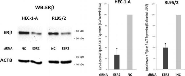 Estrogen Receptor Beta Antibody in Western Blot (WB)