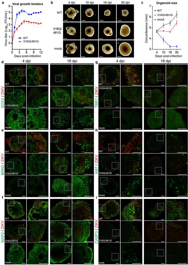 MAP2 Antibody in Immunohistochemistry (IHC)