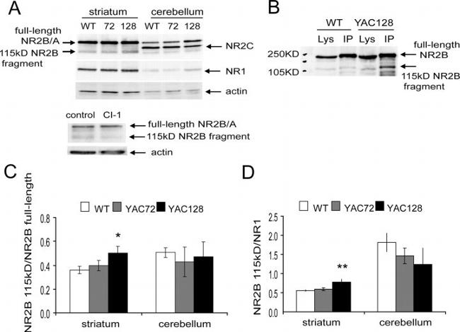 NMDAR2B Antibody in Western Blot (WB)