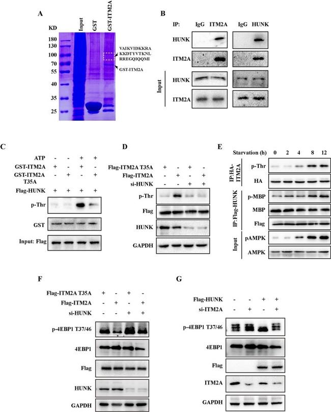 HUNK Antibody in Immunoprecipitation (IP)