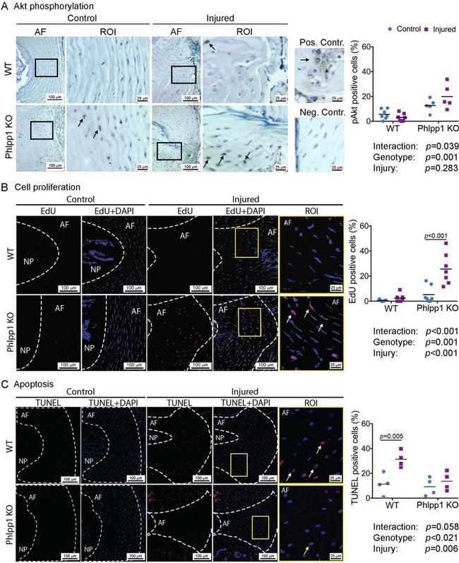 Phospho-AKT1 (Ser473) Antibody in Immunohistochemistry (IHC)