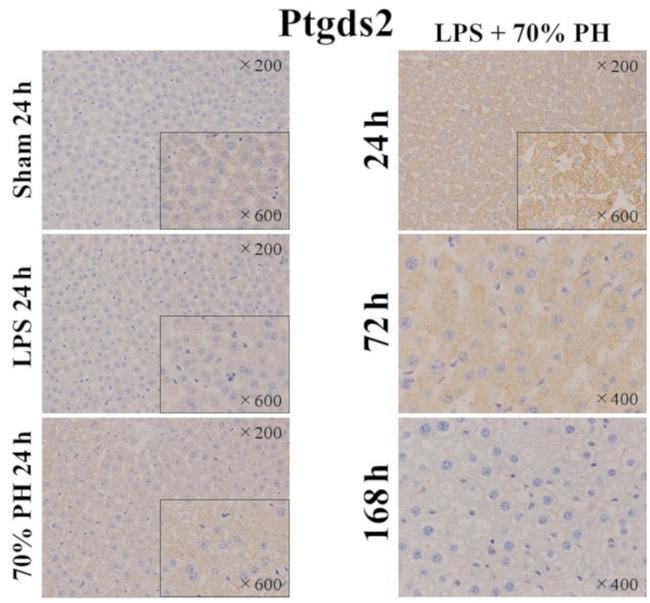 HPGDS Antibody in Immunohistochemistry (IHC)