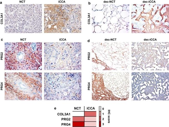 PRG2 Antibody in Immunohistochemistry (IHC)