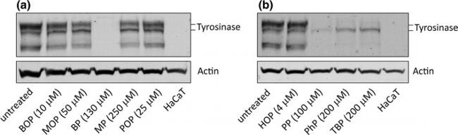 Tyrosinase Antibody in Western Blot (WB)