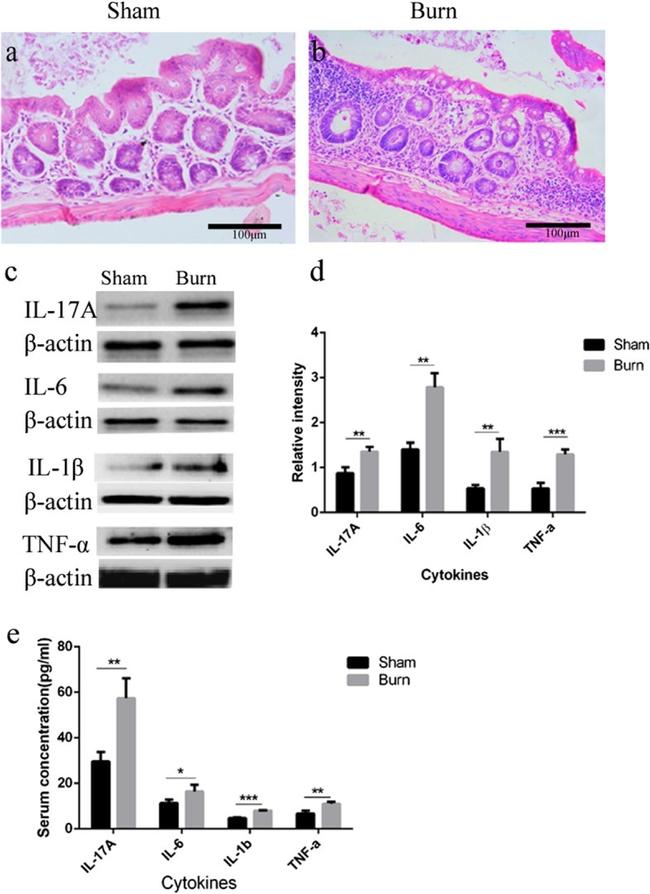 IL-6 Antibody in Western Blot (WB)