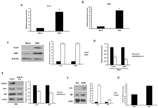 CORIN Antibody in Western Blot (WB)