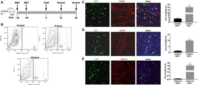 CXCR4 Antibody in Immunohistochemistry (Paraffin) (IHC (P))