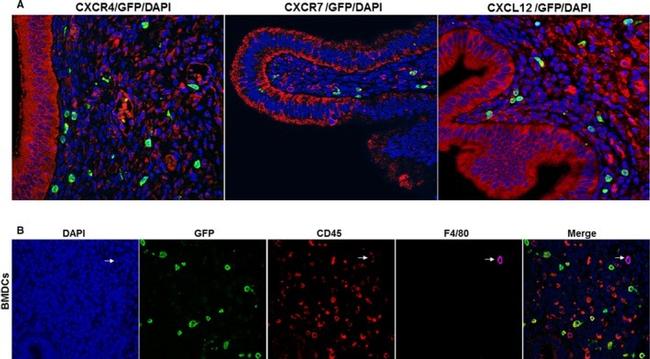 CXCR4 Antibody in Immunocytochemistry (ICC/IF)