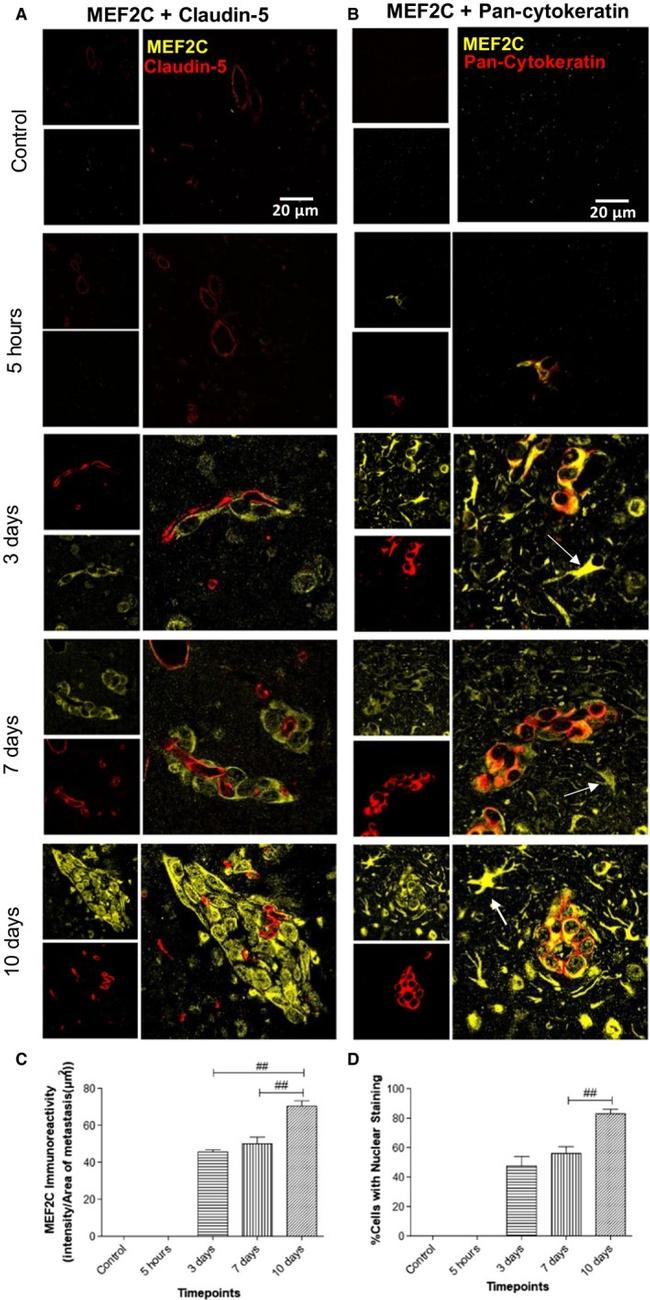 MEF2C Antibody in Immunohistochemistry (IHC)