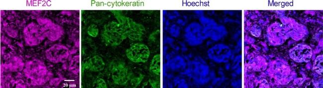 MEF2C Antibody in Immunocytochemistry (ICC/IF)