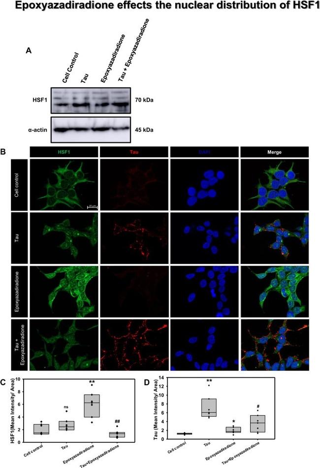 Tau Antibody in Immunocytochemistry (ICC/IF)