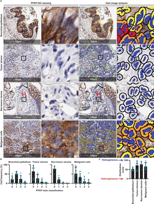 PFKP Antibody in Immunohistochemistry (IHC)