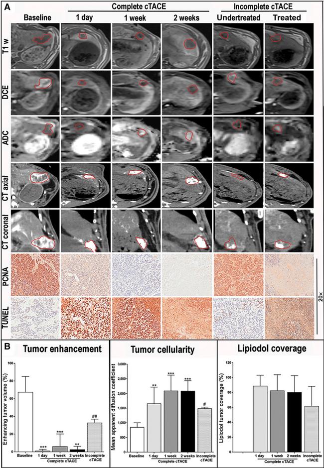 PCNA Antibody in Immunohistochemistry (IHC)