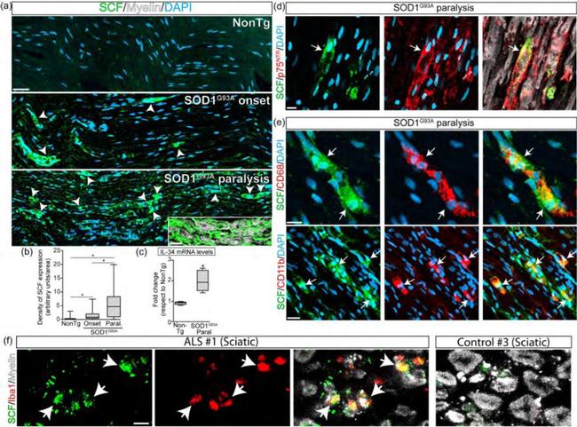 SCF Antibody in Immunohistochemistry (IHC)