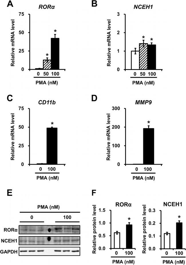 NCEH1 Antibody in Western Blot (WB)