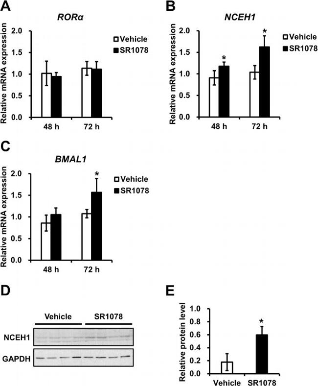 NCEH1 Antibody in Western Blot (WB)