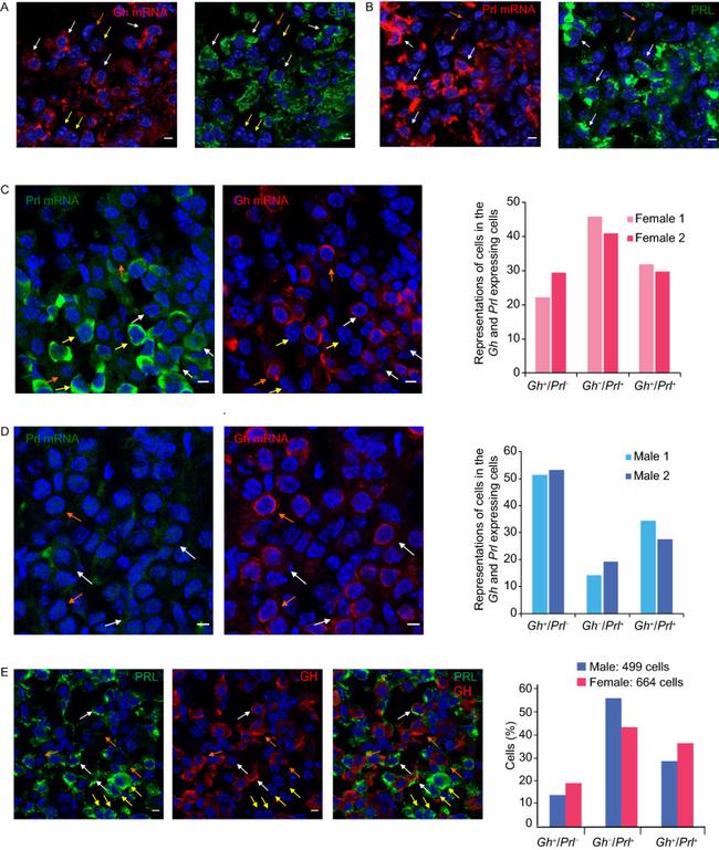 Prolactin Antibody in Immunocytochemistry (ICC/IF)