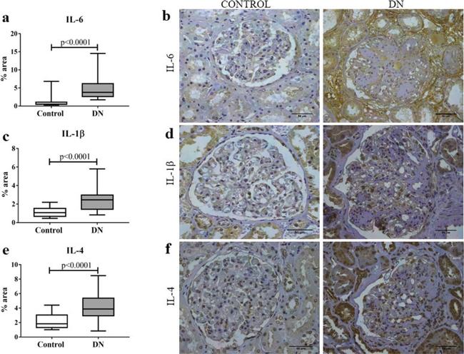 IL-4 Antibody in Immunohistochemistry (IHC)