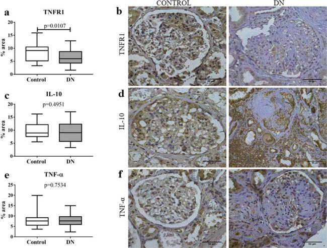 IL-10 Antibody in Immunohistochemistry (IHC)